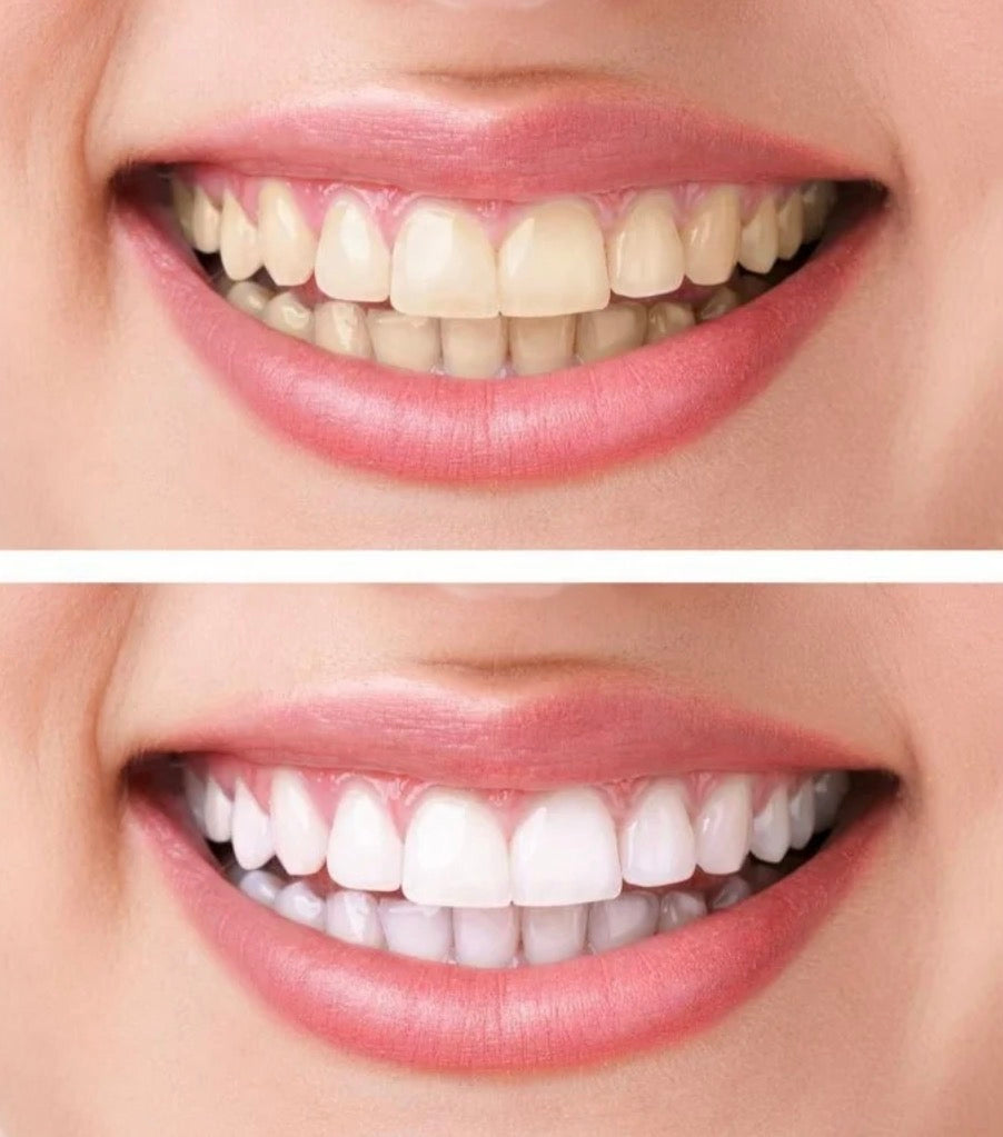 Beauty and Wound JARENGO V34 purple color corrector for teeth whitening and stain removal, featuring a sleek tube and applicator.